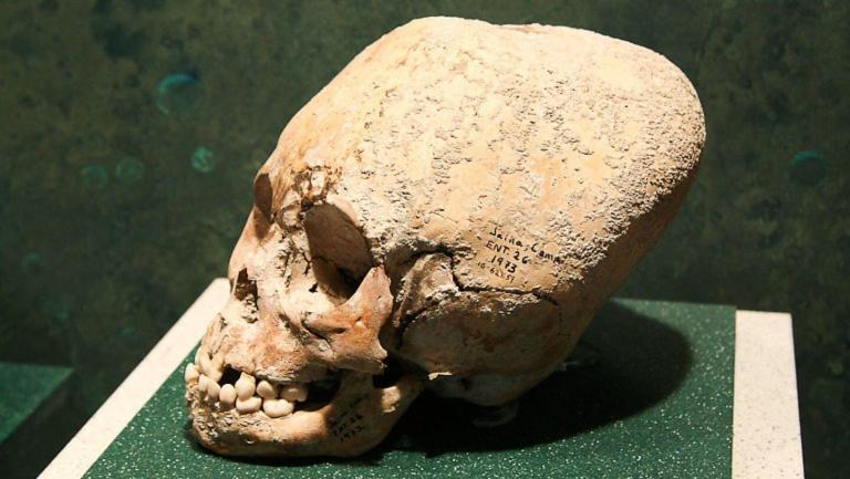Why did the Mayans Practice Cranial Deformation?