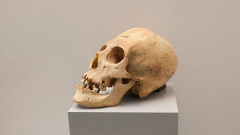 Cranial Shaping